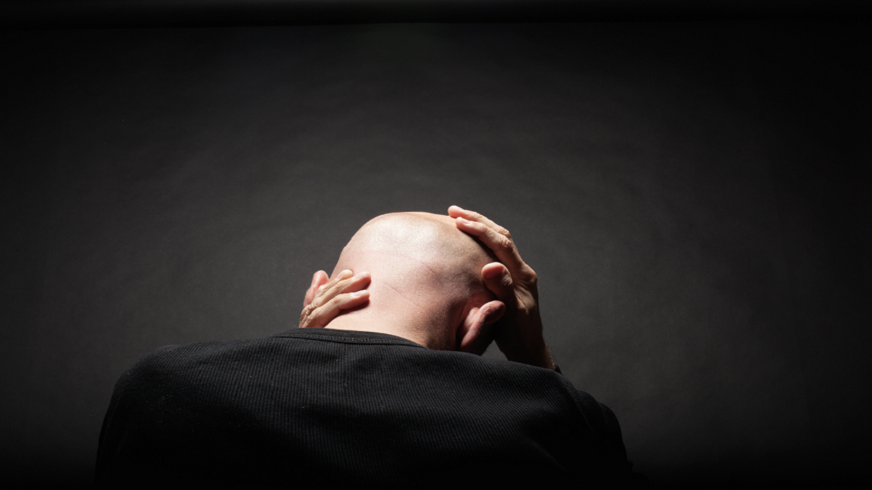 أصابعك والصلع ما العلاقة؟