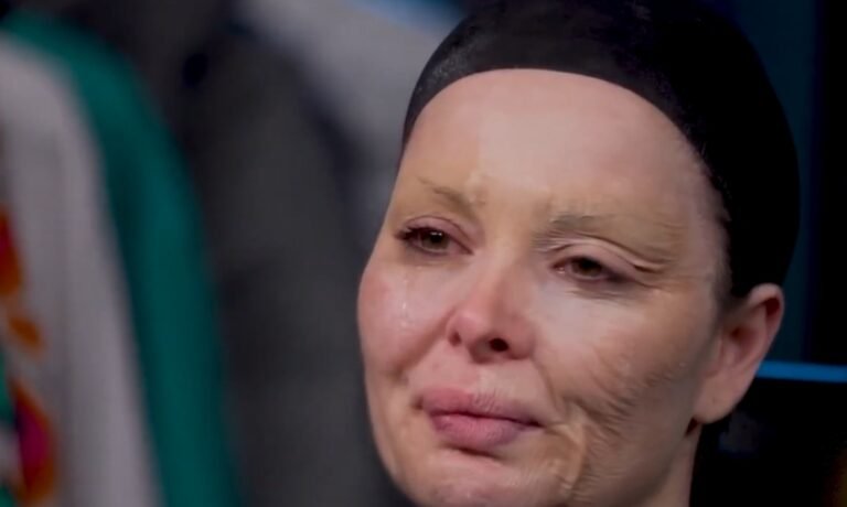 بعد أن أصبحت عجوز.. ماذا قالت الفنانة كرزون وهي تذرف دموعها؟- فيديو وصور